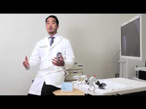 What are the risks associated with the LINX procedure?