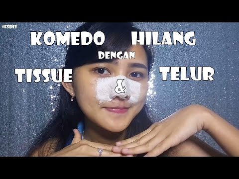 download lagu mp3 mp4 Tips Menghilangkan Komedo Dengan Putih Telur, download lagu Tips Menghilangkan Komedo Dengan Putih Telur gratis, unduh video klip Tips Menghilangkan Komedo Dengan Putih Telur