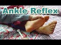 How to Do Ankle Reflex | Achilles Tendon Reflex | Deep Tendon Reflexes | S1, S2 Spinal Cord Segments