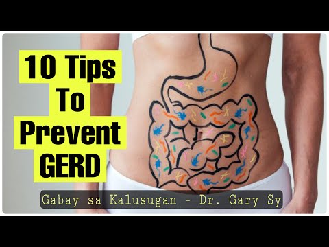10 Tips To Prevent GERD (Acid Reflux or Heartburn) - Dr. Gary Sy