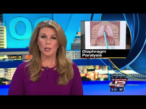 VIDEO: Diaphragm paralysis: 'It was completely debilitating'