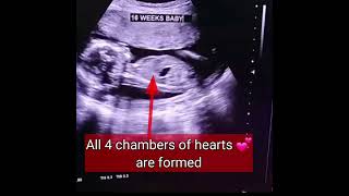 4 months baby in mothers womb / 16 weeks/ shorts/ shortvideo/ Drhome