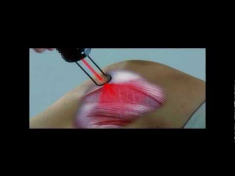 La differenza di artrite e artrosi Polydex per giunti cane