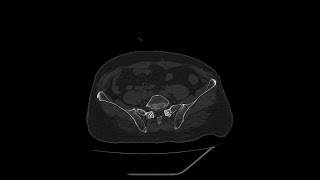 Case of the Day - 26 Nov 24