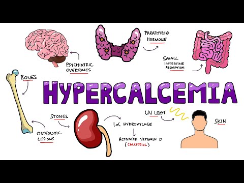 Understanding Wilson s Disease Hepatolenticular Degeneration