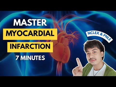 Cómo signar Miocardio en LSE