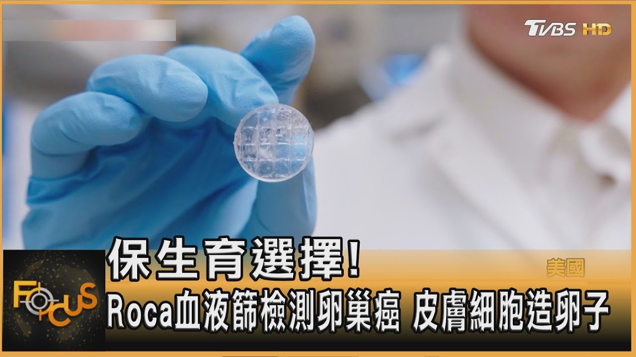 保生育選擇!Roca血液篩檢測卵巢癌 皮膚細胞造卵子
