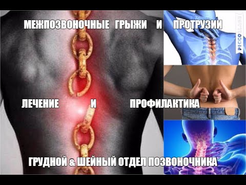 Какая мазь лучше от боли в коленном суставе Ддз грудного отдела позвоночника что это такое