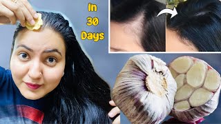 30 Days *Hairline Regrowth* Challenge : Receding Hairline, Bald Patches हल्के बालों को करें घना 100%