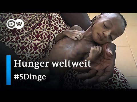 Steigende Hungersnot: Diese Länder sind am schwersten betroffen | 5 Dinge