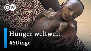 Steigende Hungersnot: Diese Länder sind am schwersten betroffen