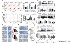 RC48 Suppresses Tumor Growth and Reduces Tumor Burden in the A2058 and SK-MEL-28 cells