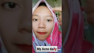 Download lagu Snail truecica - some by me mp3