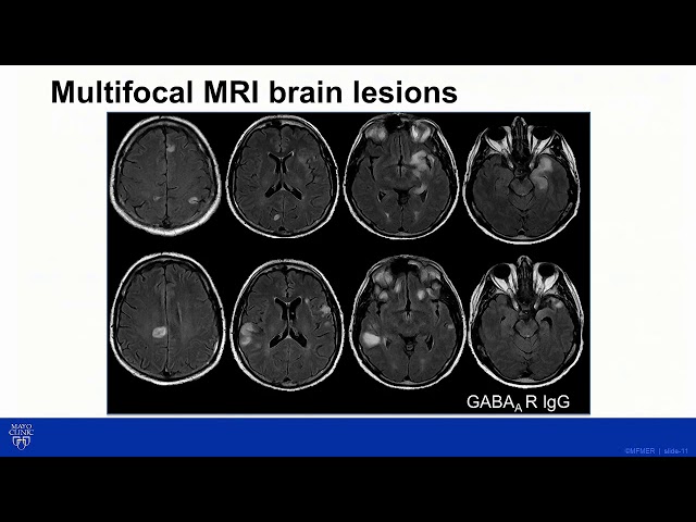 How to pronounce Divyanshu | HowToPronounce.com