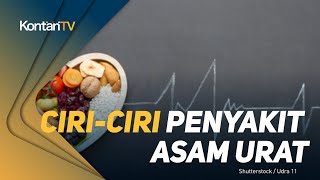Download lagu Ciri-Ciri Penyakit Asam Urat & Obat Alami mp3