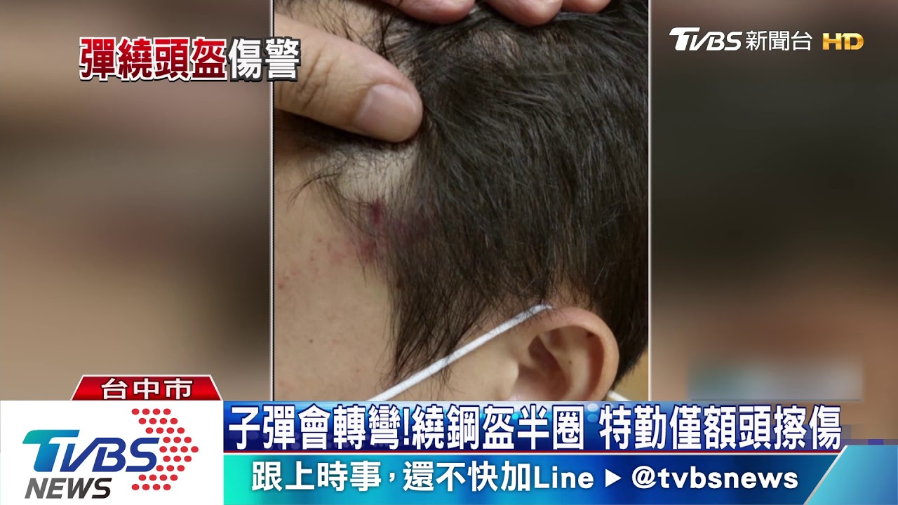 子彈會轉彎 繞鋼盔半圈 特勤僅額頭擦傷
