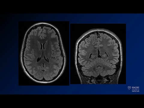 Neuroradiology board review lecture 1 case 16