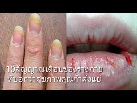 โรคสะเก็ดเงินและเชื้อราที่เล็บ ครีมบรรเทาอาการคันกลาก