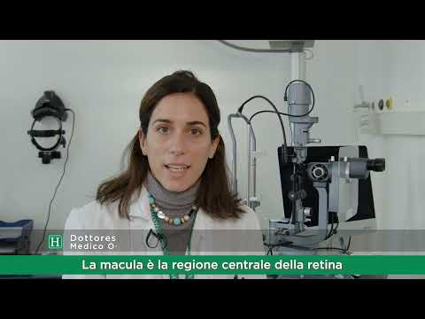 Che cos'è la macula?