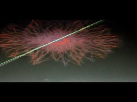 Fersensporn Gelenk HWS Abnormalität Kimmerly