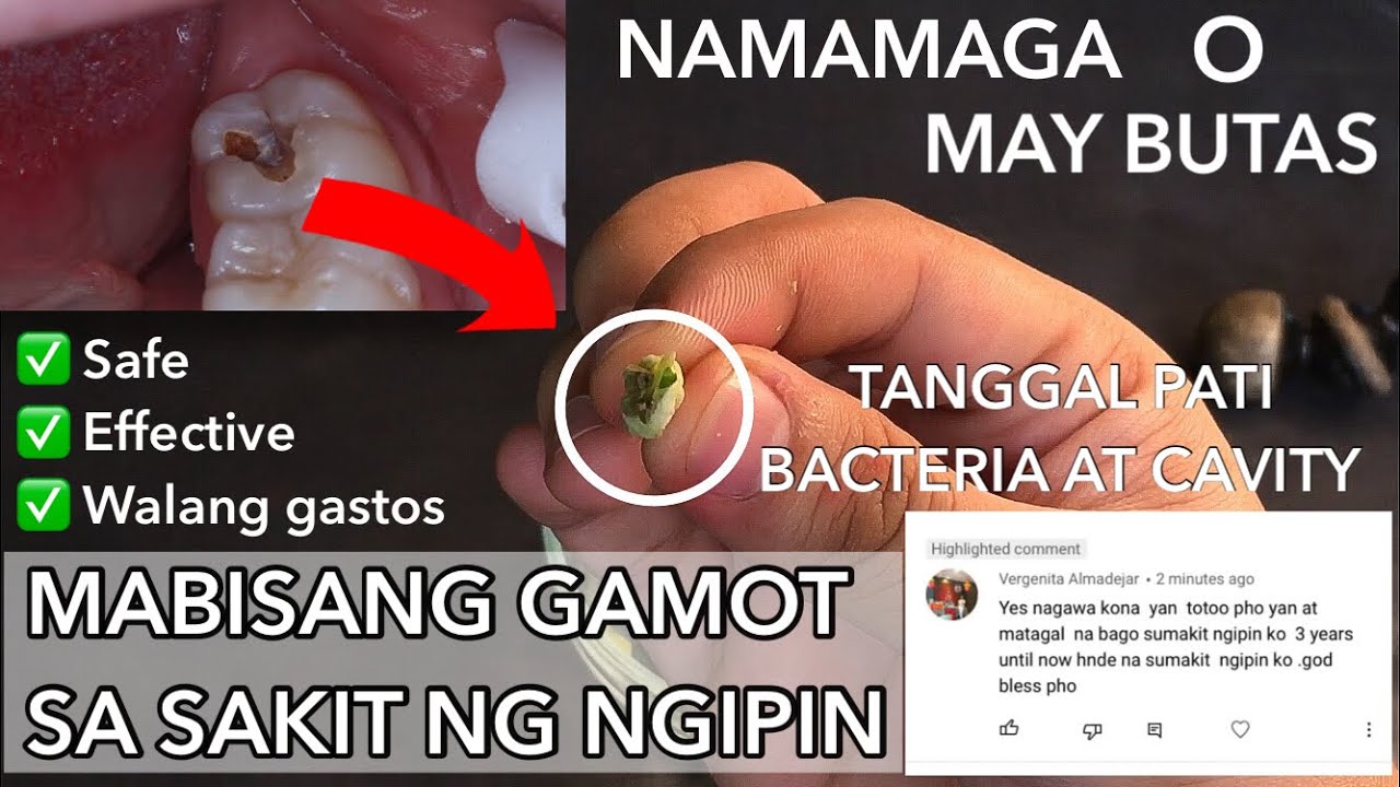 Effective tips at Mabisang Gamot sa sakit ng ngipin | Ito na ang gamot na hinahanap niyo