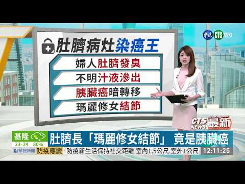 肚臍長「瑪麗修女結節」 竟是胰臟癌