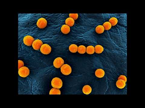 Avendo cura della prostata Adenoma prostatico cane 5