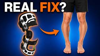 OA Unloader Knee Brace (Knee Arthritis Expert Review)