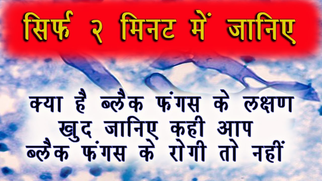 खुद जानिए कही आप ब्लैक फंगस के रोगी तो नहीं क्या है ब्लैक फंगस के लक्षण शुरुवात में सतर्क हो जाये