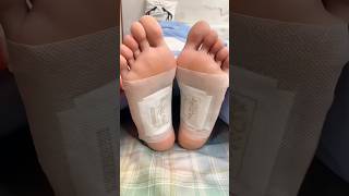 Download lagu Detox Foot Patches mp3 Download lagu Detox Foot Patches mp3
