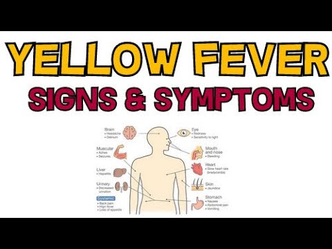 YELLOW FEVER - SIGNS AND SYMPTOMS