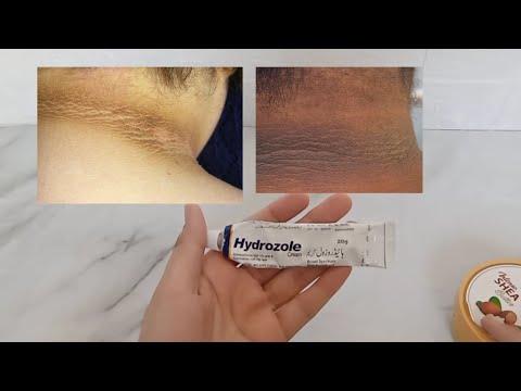 Neck Whitening Formula|| Neck Whitening Remedy|| Glow Guide By Aroosh