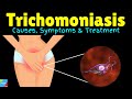 Trichomoniasis: Causes, Symptoms, Diagnosis, Treatments and prevention