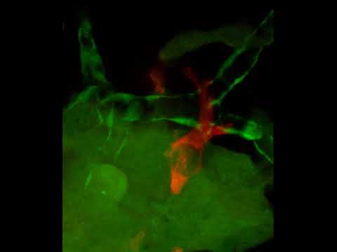 MAX10 31 zmel cttntagRFPT in kdrlGFP 1dpi Airyscan Processingcroppedcttn and BV