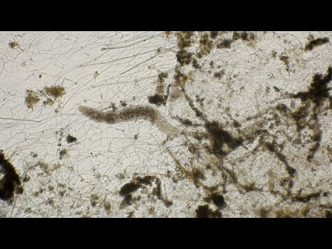 Movement of the Worm Oligochaet Under the Microscope | Stock Footage - Videohive