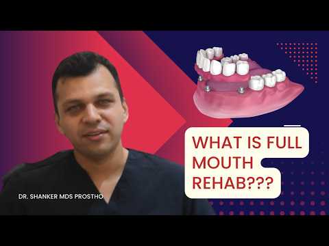 What is Full Mouth Rehabilitation?