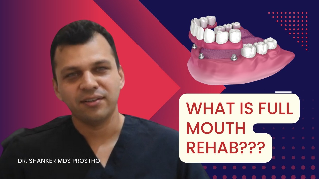 What is Full Mouth Rehabilitation?