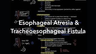 Tracheoesophageal Anomalies Explained: Esophageal Atresia & TEF (High-yield)
