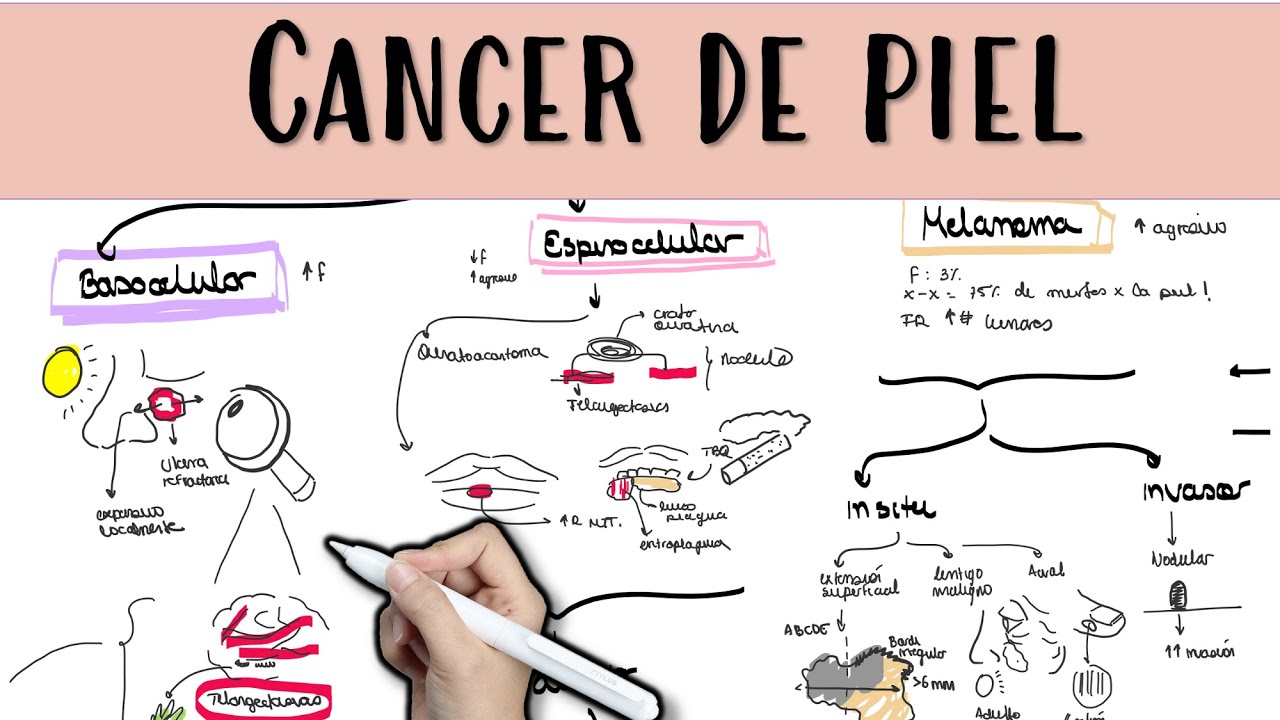 CANCER DE PIEL MELANOMA Y NO MELANOMA #melanoma #basocelular #espinocelular #breslow #dermatologia