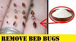 How To Remove Bed Bugs With Baking Soda | At Home