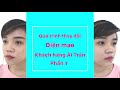 Mình đã khóc ngay trong phòng mổ, ước mơ nâng mũi 10 năm đã thành hiện thực
