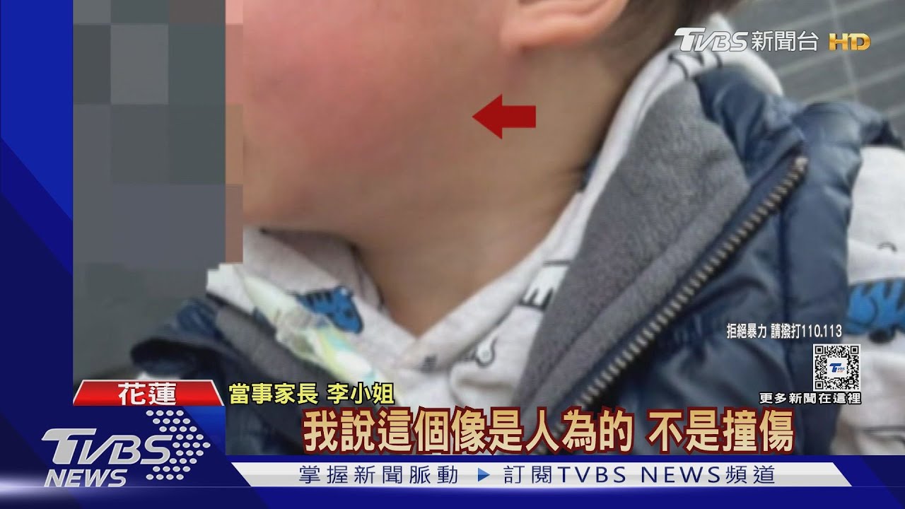 誰打的?1歲童受傷 竟是「保母丈夫」施暴