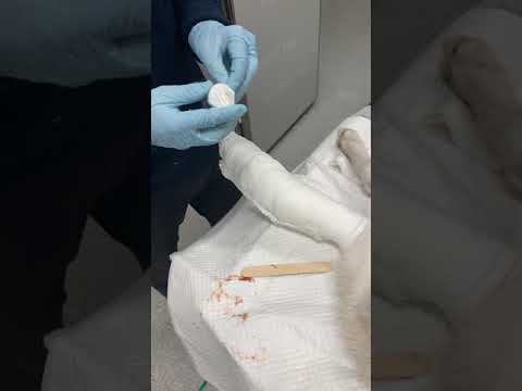 Bandage Application Video - wounds