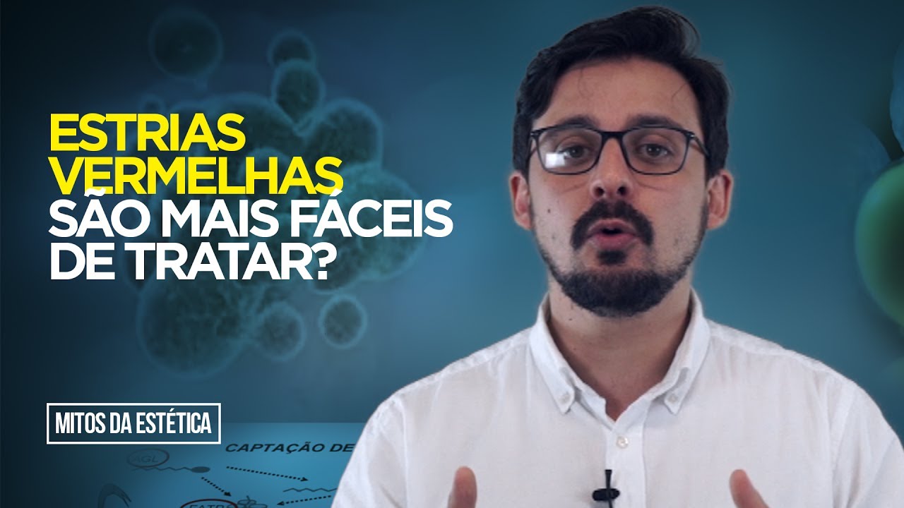 Estrias vermelhas são mais fáceis de tratar? - Mitos da Estética #4