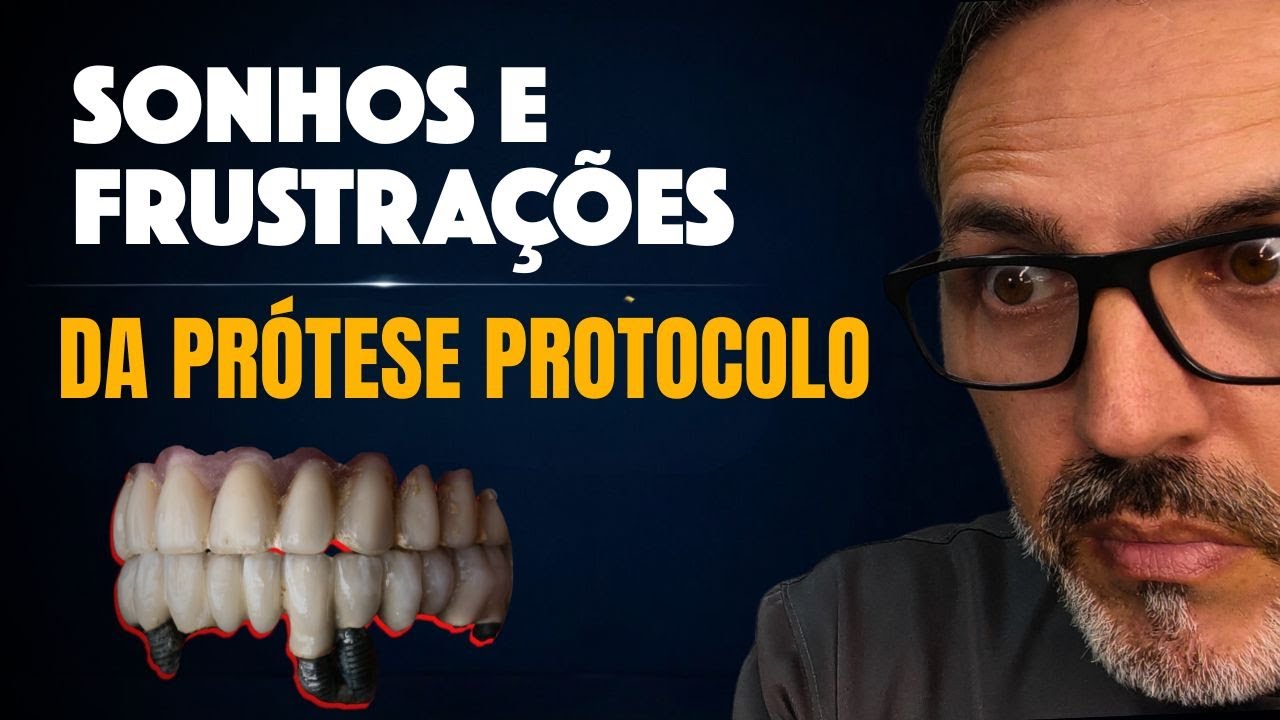 O que as Pessoas Mais Odeiam Quando Fazem Implantes, Veja Aqui