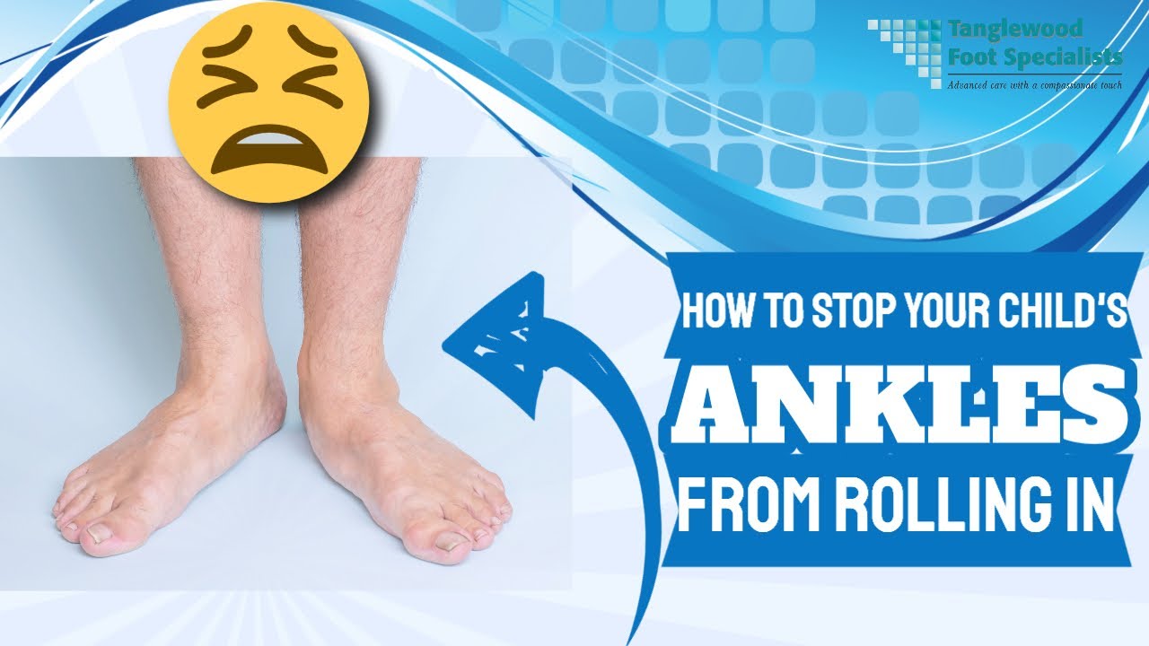 Childs Ankles Rolling In Flat Feet in Kids Tanglewood Foot Specialists