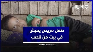 طفل يسكن في بيت من قصب ويطلب العون بسبب مرض نادر "أنا مريض بغيت الناس يعاونوني" thumbnail