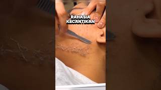 Download lagu This is a beauty clinic secret that not many people know. mp3