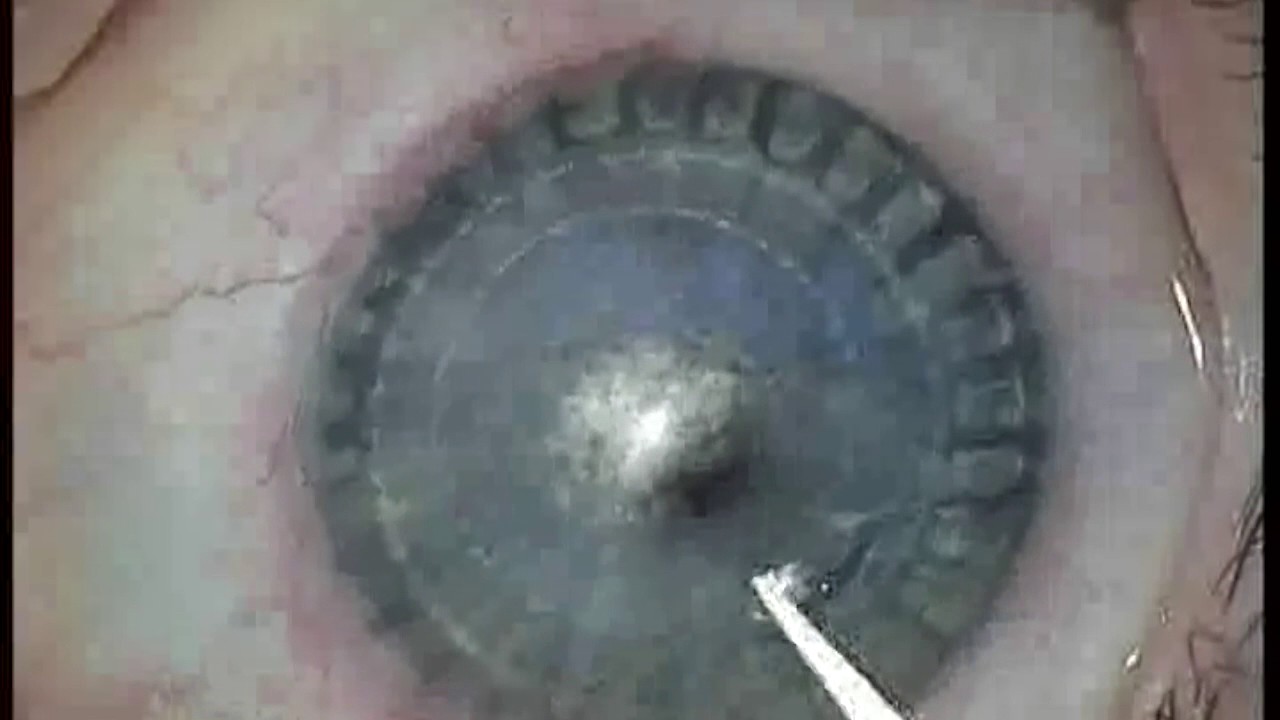 Alessandro Sammartino-7