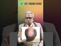 Best Homeopathy Medicine For Baldness Dr P S Tiwari